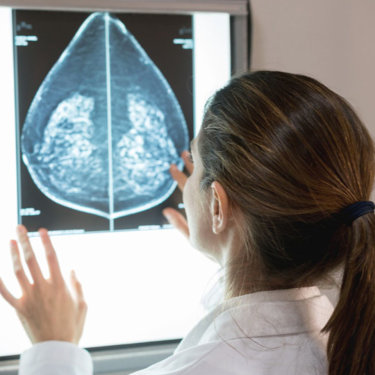 Breast density and mammograms: New FDA rule will ensure all women have more information after cancer screenings