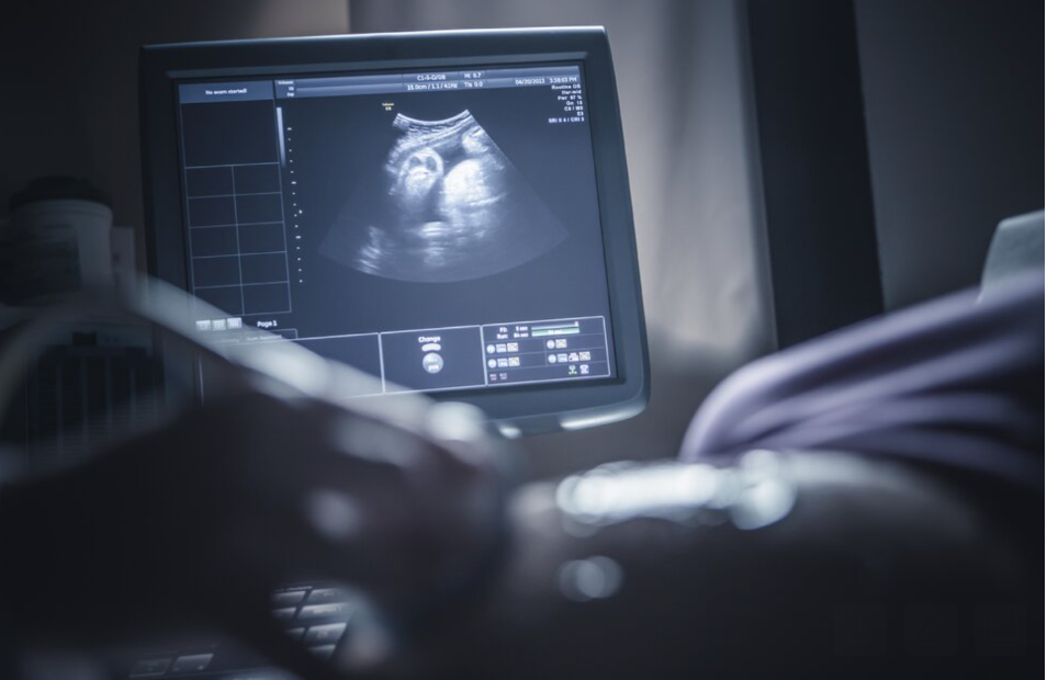 As the U.S. Struggles With a Stillbirth Crisis, Australia Offers a Model for How to Do Better