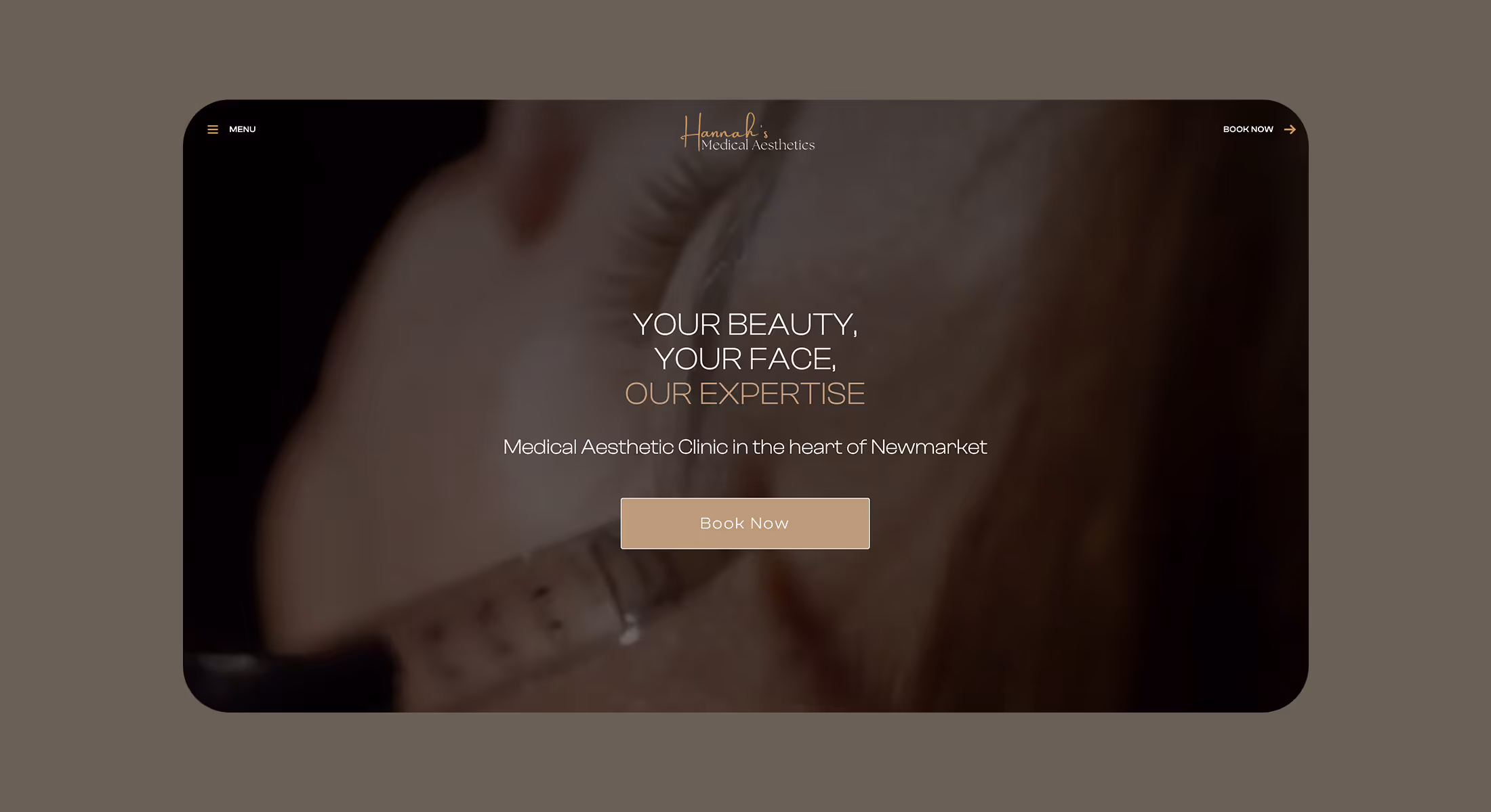Hannah's Medical Aesthetics website hero for the Newmarket clinic