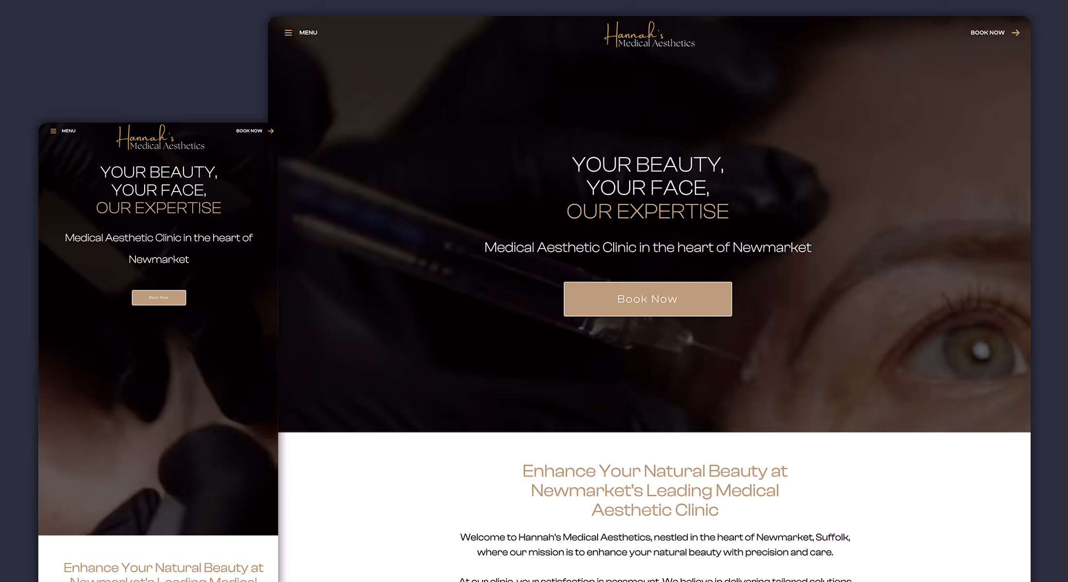 Webflow website design for Hannah's Medical Aesthetics showing its Newmarket clinic homepage