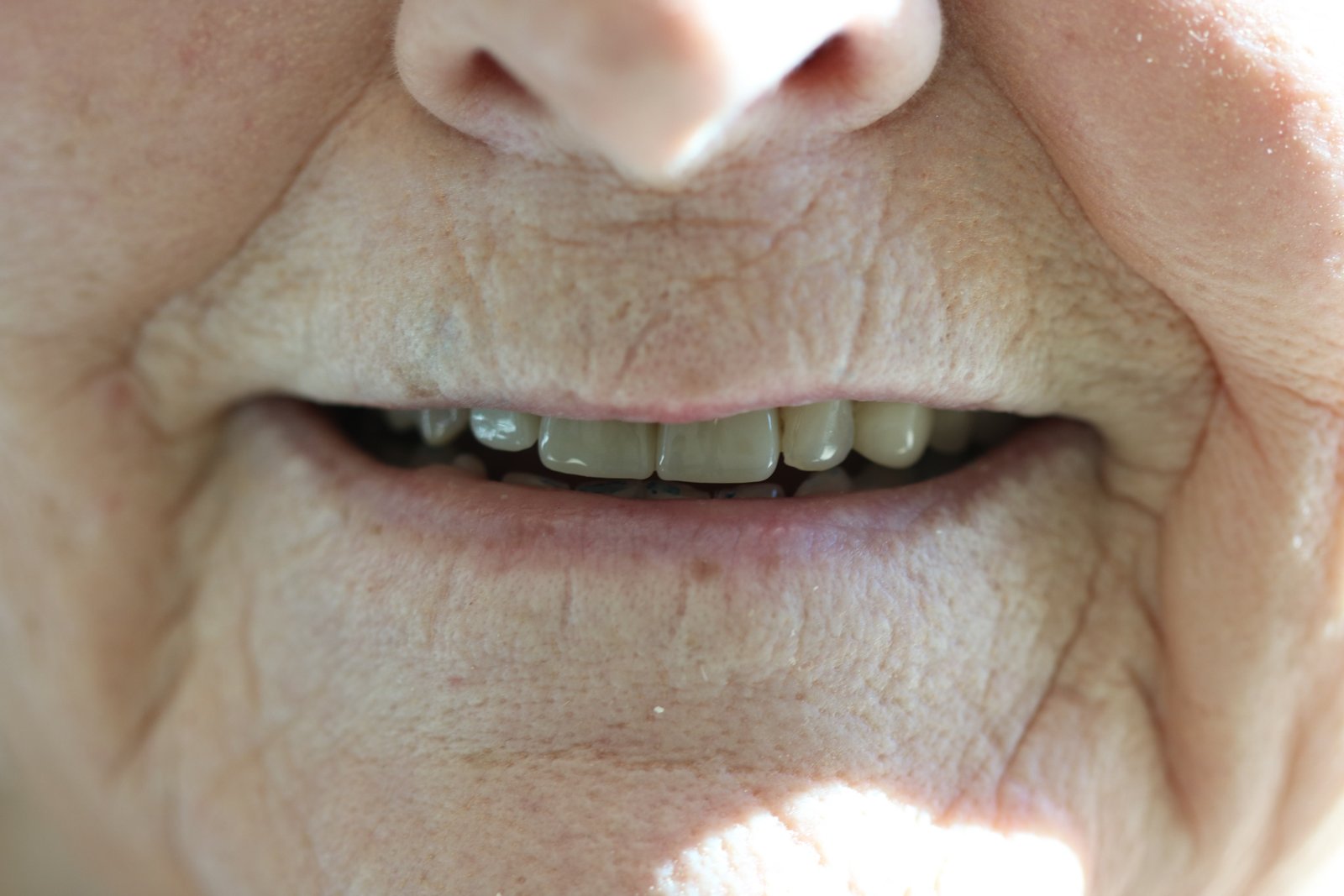 After: missing front tooth replaced at White Rose Dentistry