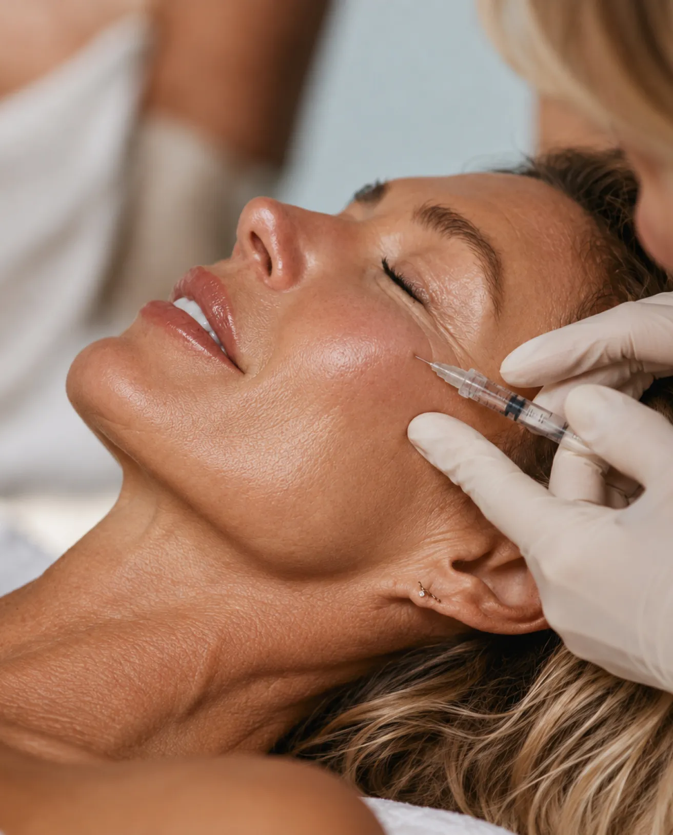 Dermal Fillers treatment