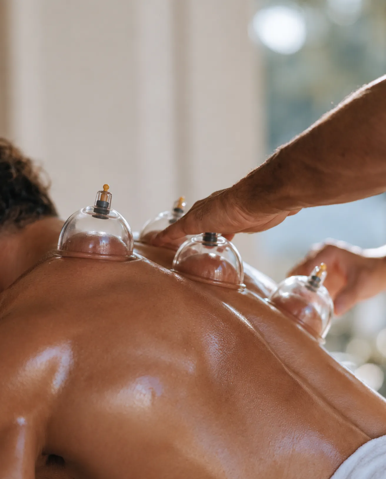 Cupping therapy session