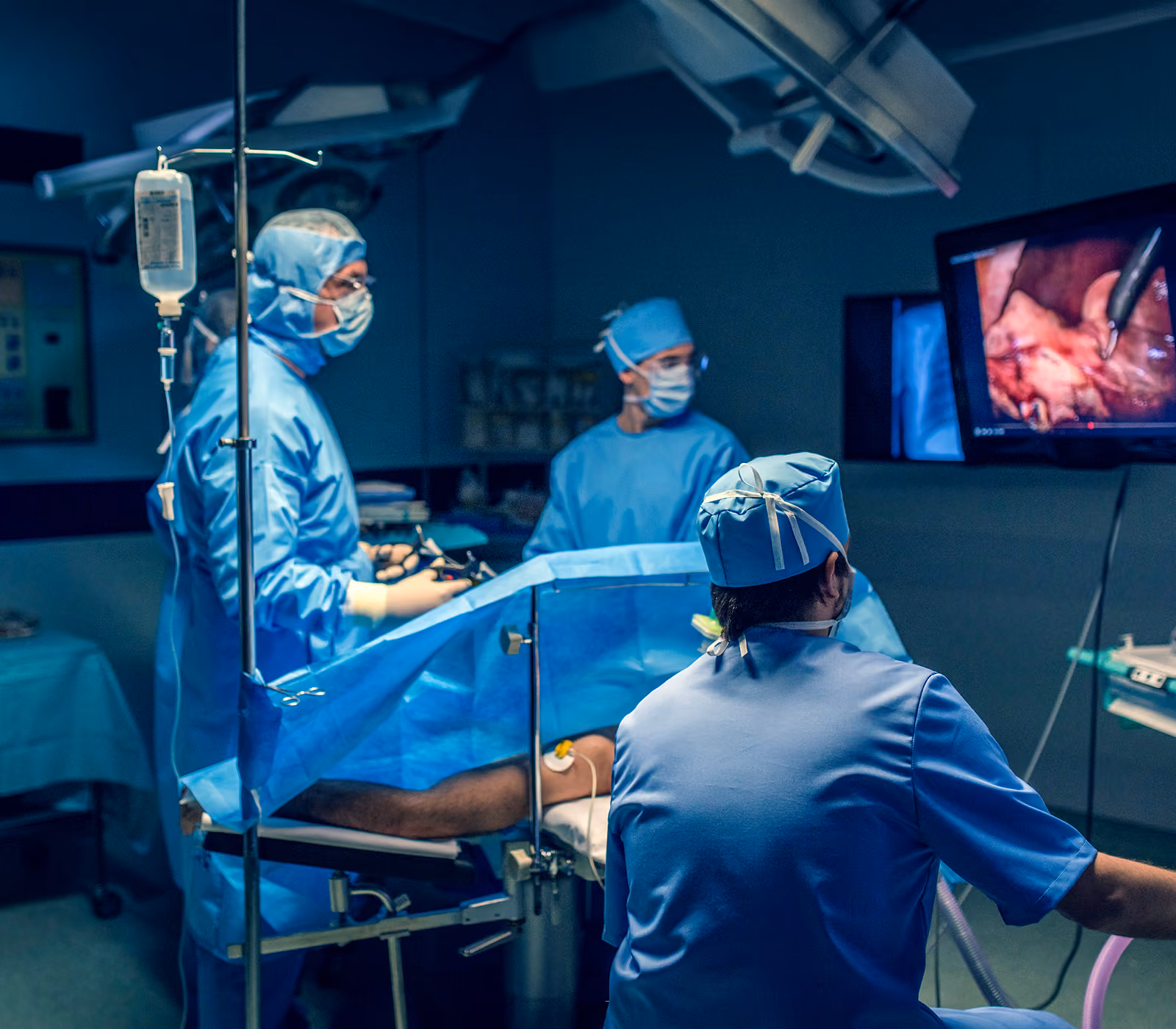 Surgical team dressed in blue scrubs and masks performing a minimally invasive laparoscopic surgery with an IV drip visible, while monitoring the procedure on a screen showing internal organs.