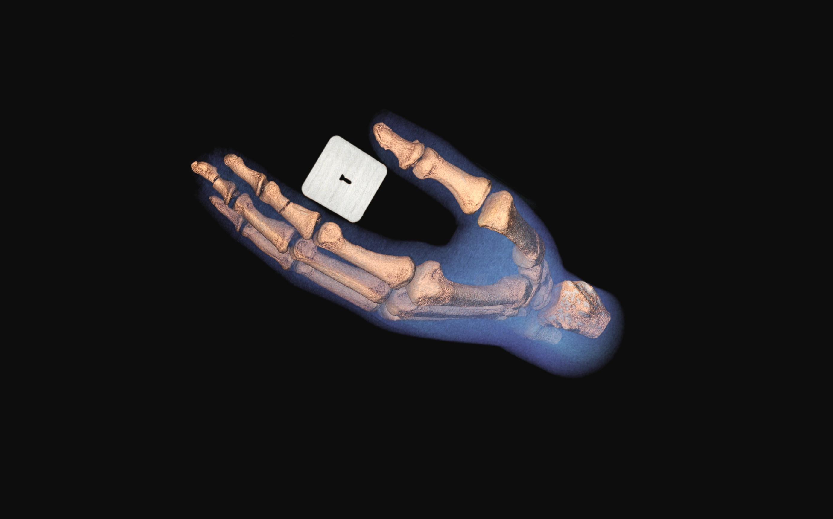 Colour 3D spectral CT image of a hand and wrist bones