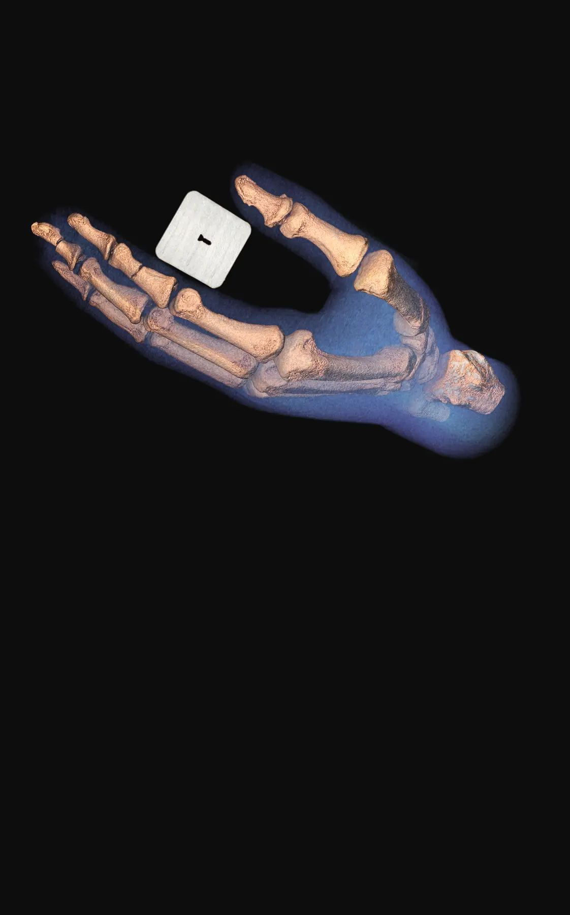 Colour 3D spectral CT image of a hand and wrist bones