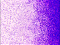 Outcomes of in vitro-biofilm
