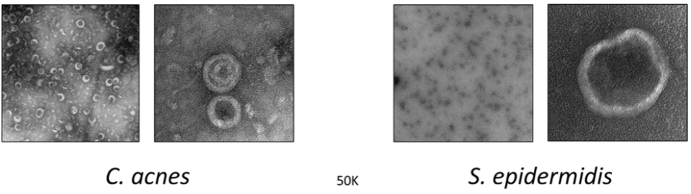 Fig. Extracellular vesicles produced by Cutibacterium acnes and Staphylococcus epidermidis imaged with TEM