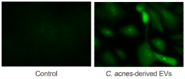 Fig. Filaggrin expression of keratinocytes exposed to EVs from C. acnes