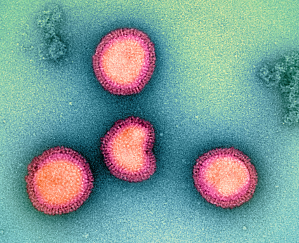 Influenza B: A Silent Threat with Heavy Consequences