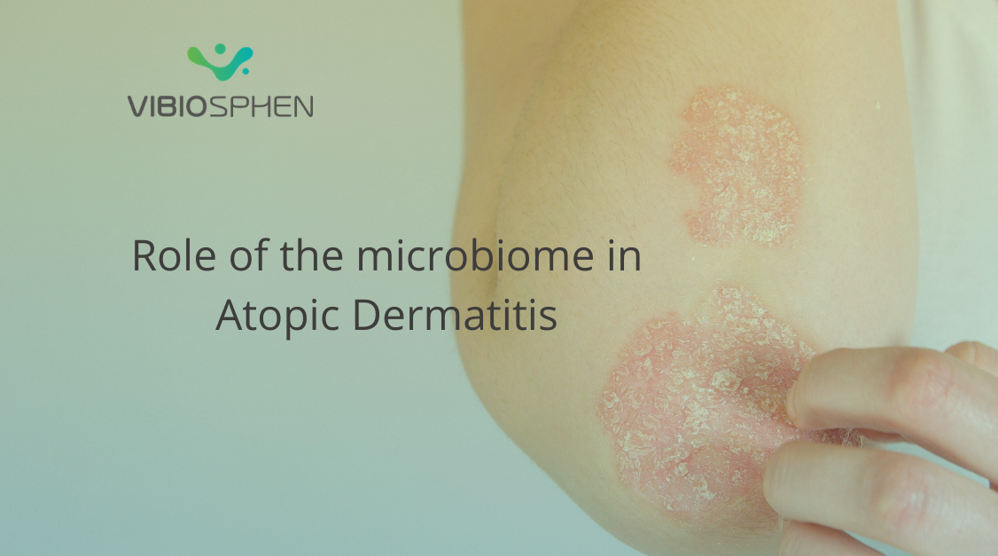 Role of the microbiome in Atopic Dermatitis