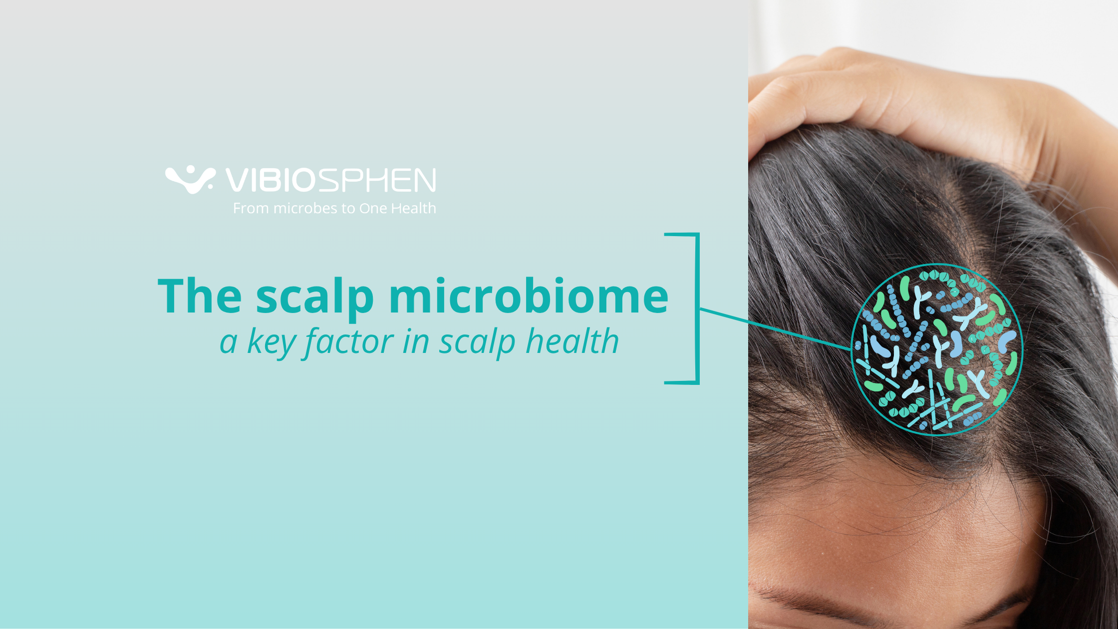 The scalp microbiome