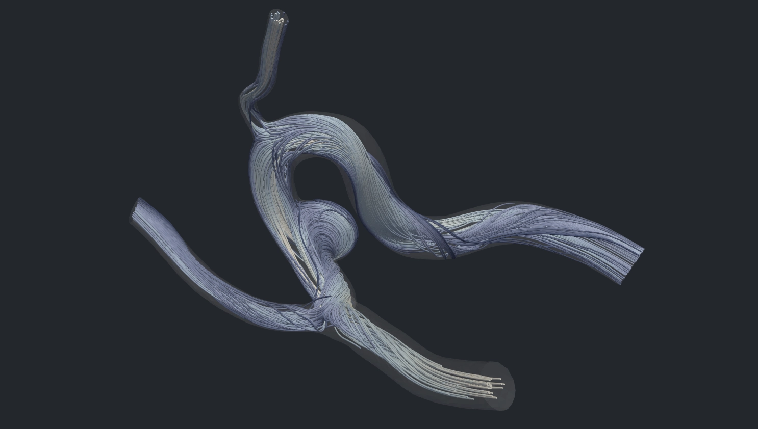Pre-implant flow in a virtual patient: simulated pathlines through the vessel and aneurysm.