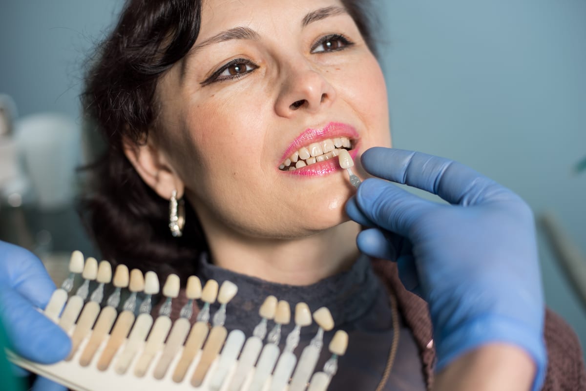 Are You Actually a Good Candidate for Veneers?
