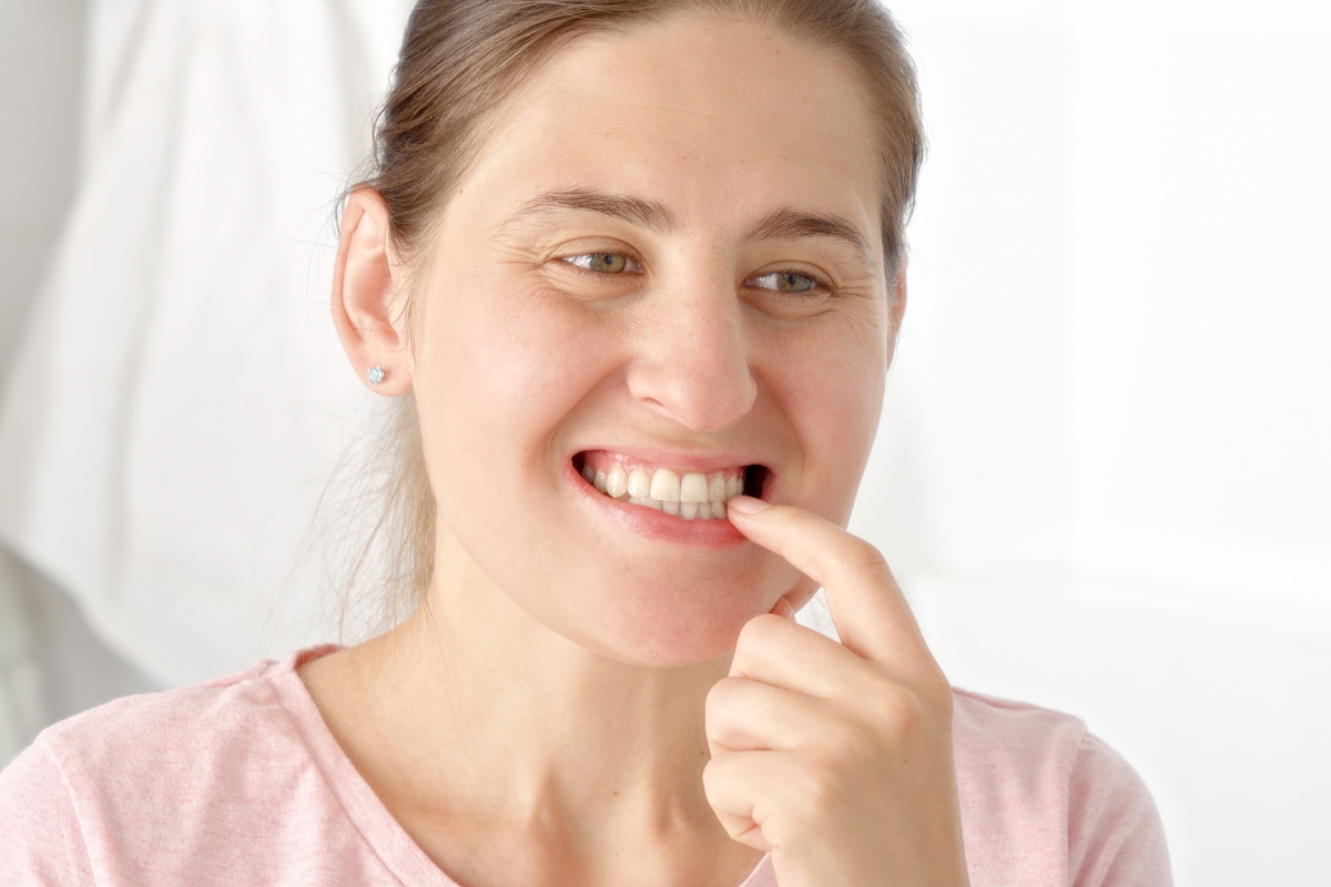 How Professional Fluoride Treatment Stops Early-Stage Cavities in York