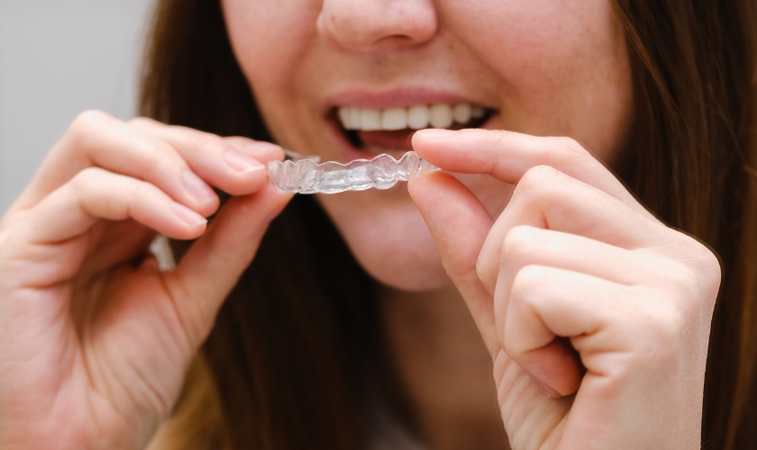 Deciding If Clear Aligners Are the Ideal Choice for Your Smile Transformation