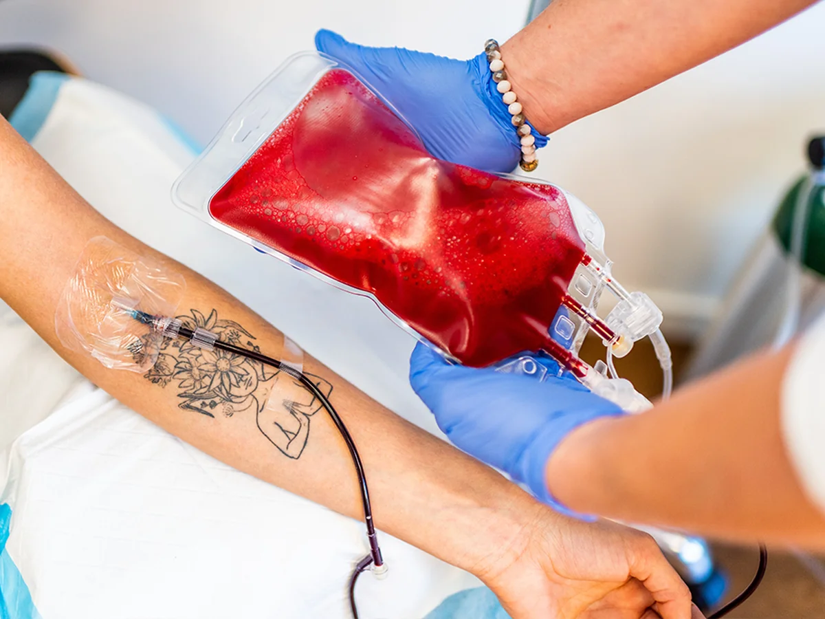 Clinician's gloved hands holding a major autohemotherapy (MaH) blood bag connected by IV tubing to a patient's arm