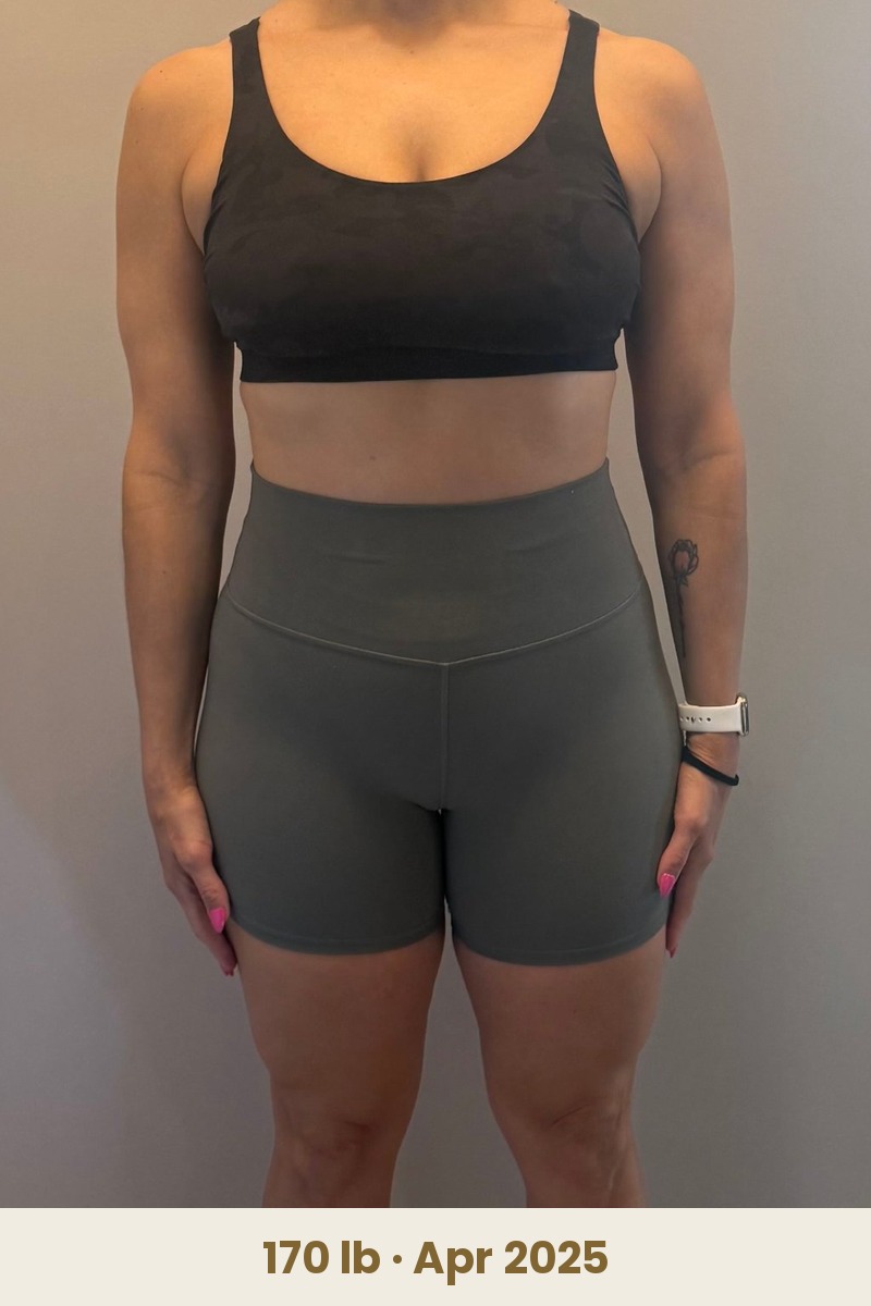 Stacey V. before, 170