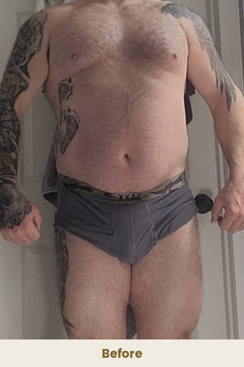 Dustin A. before