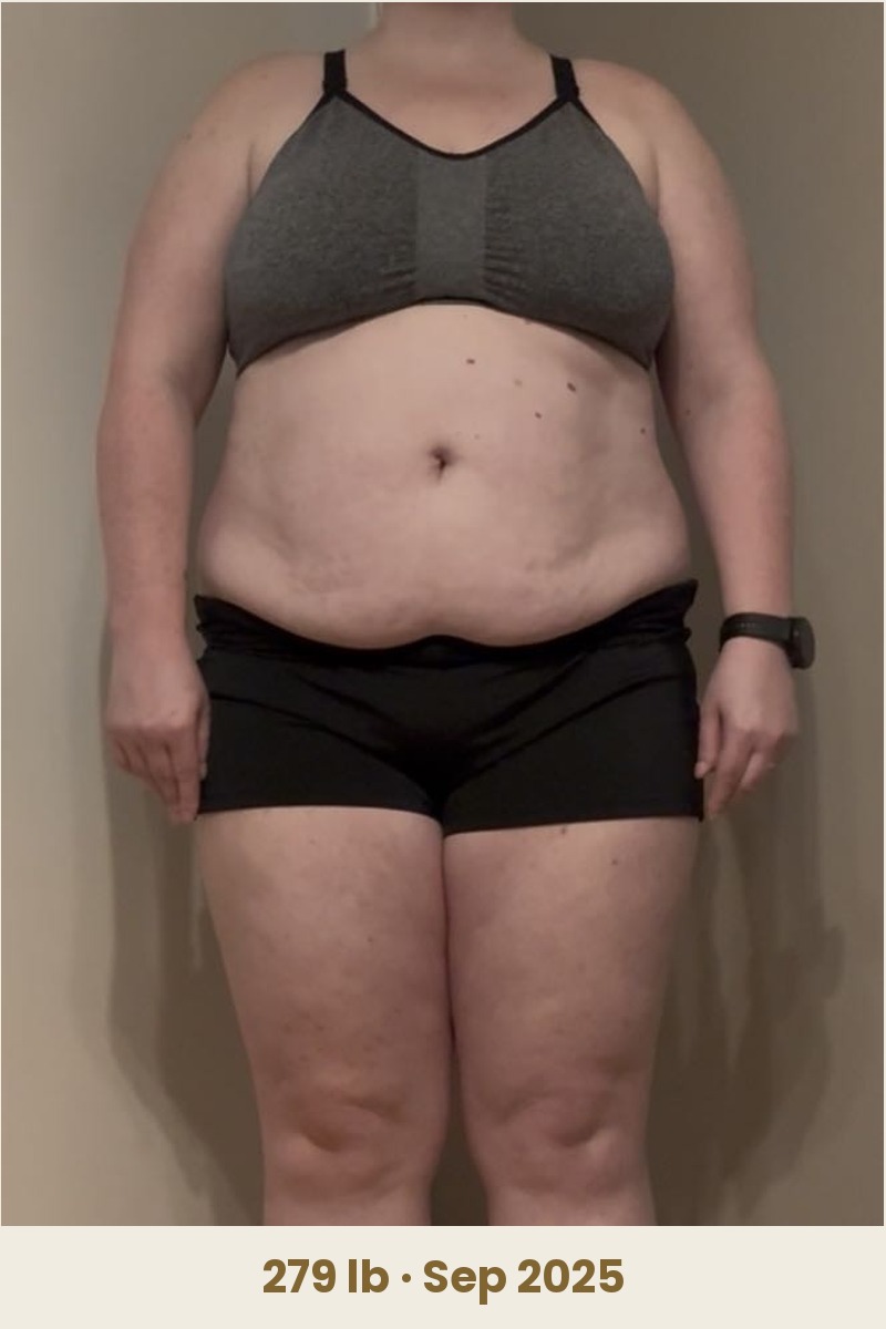 Meghan T. before, 279
