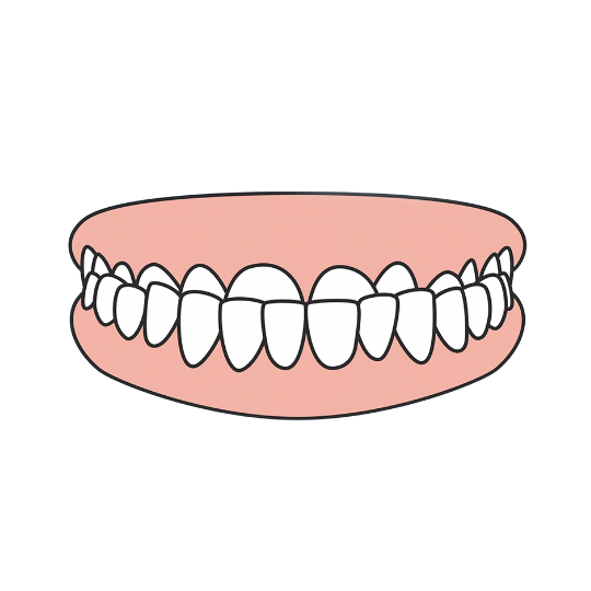 Underbite