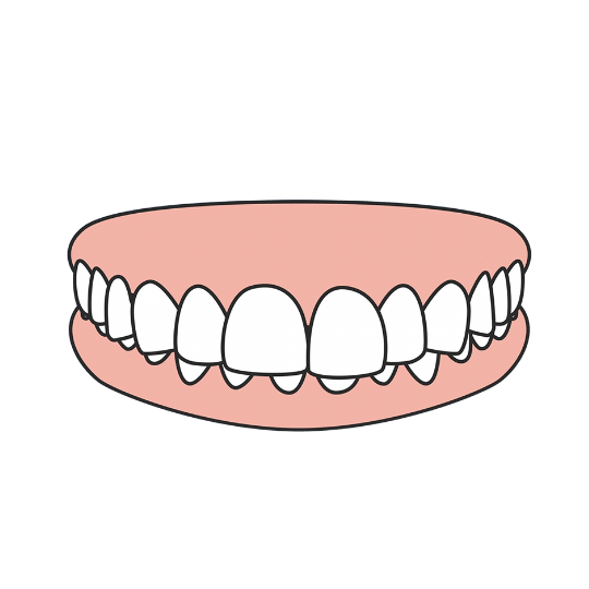 Overbite