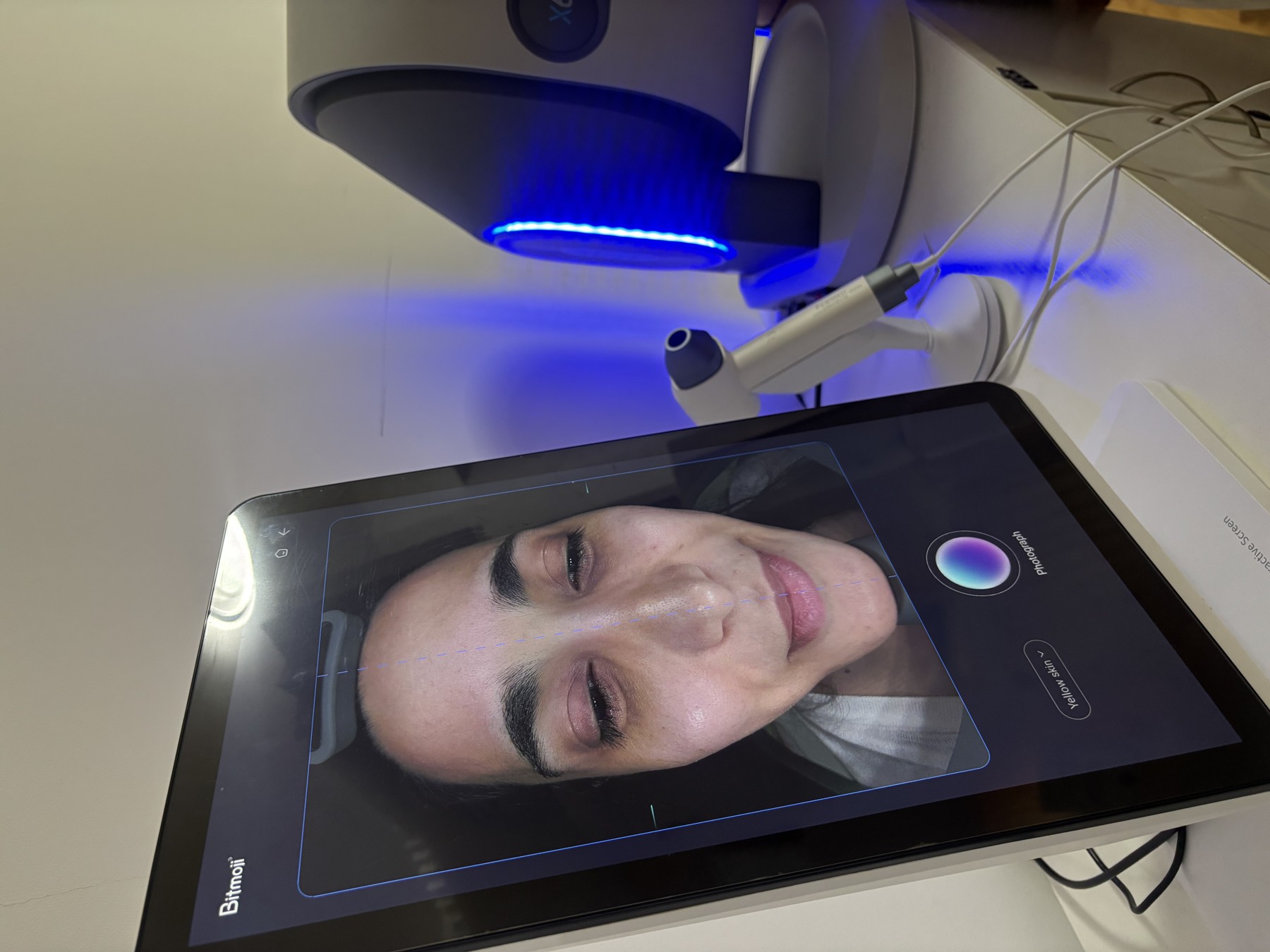 Skin analyzer and facial imaging screen at Mahjan SkinCare