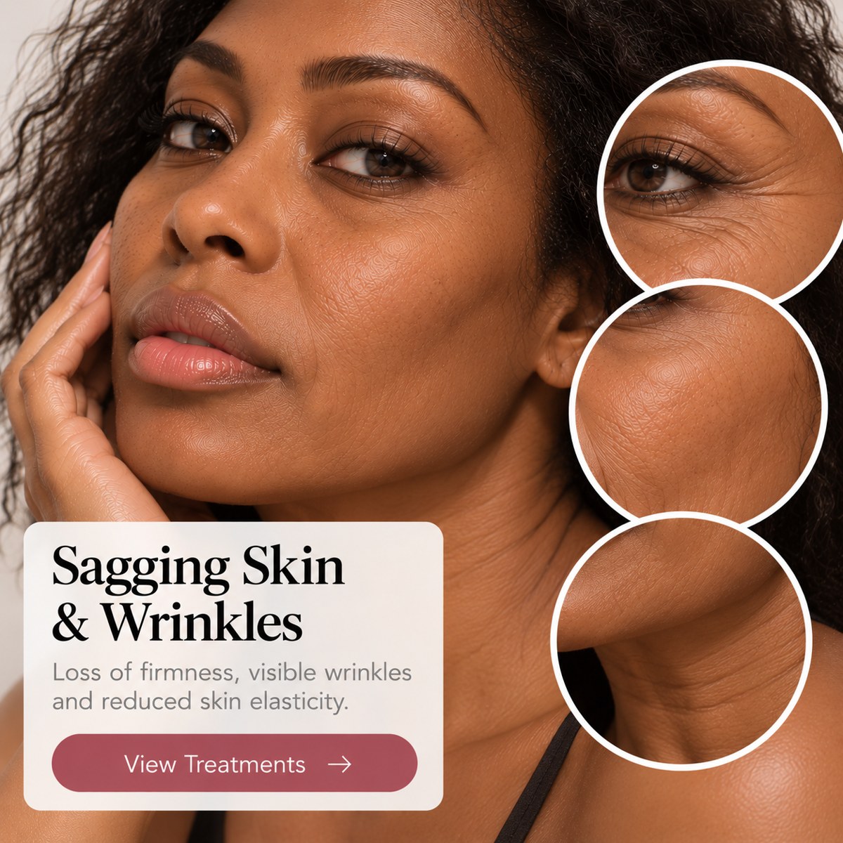Sagging Skin & Wrinkles