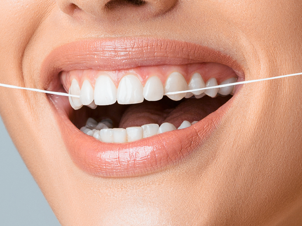Smile after porcelain veneers