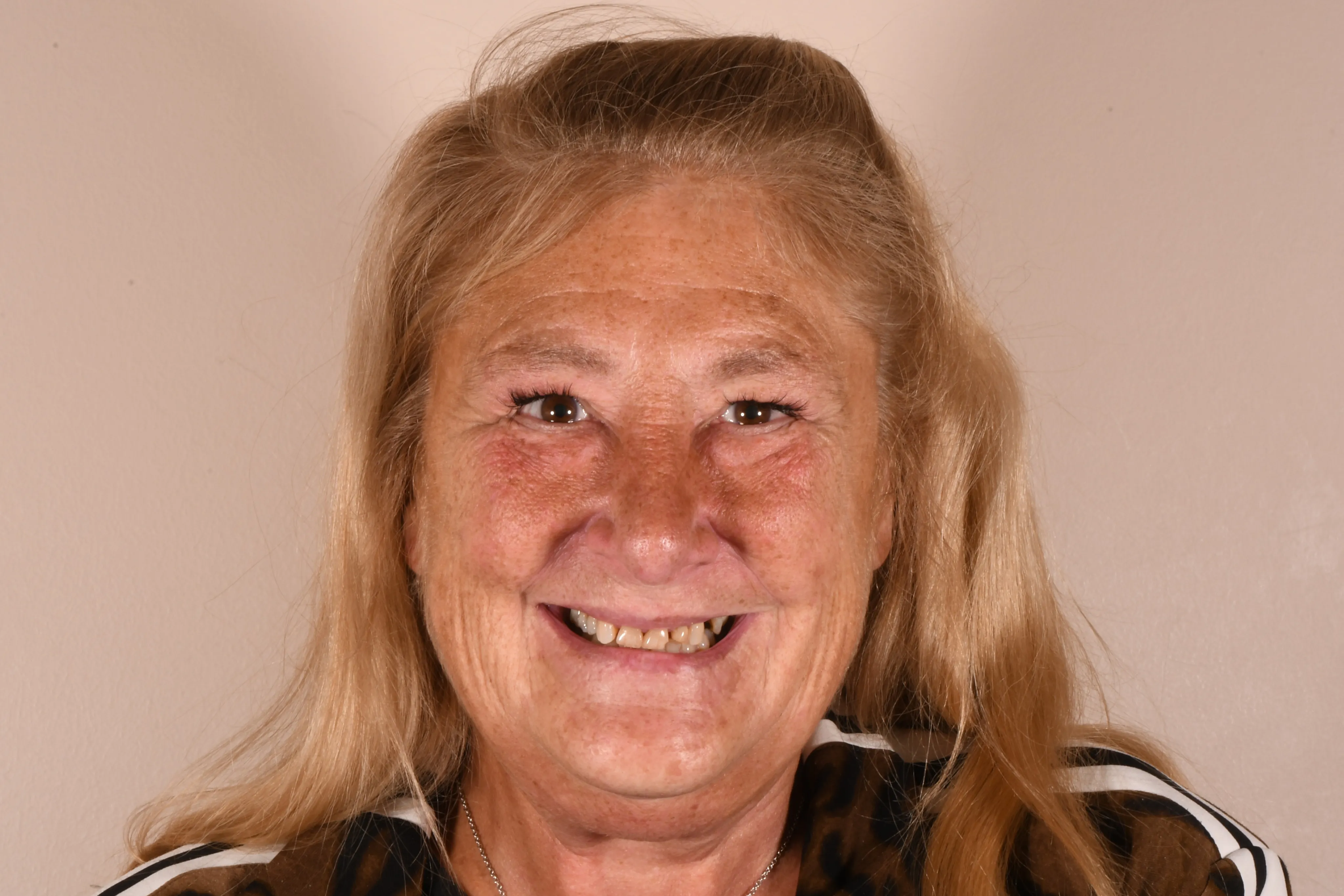 Patient face before treatment