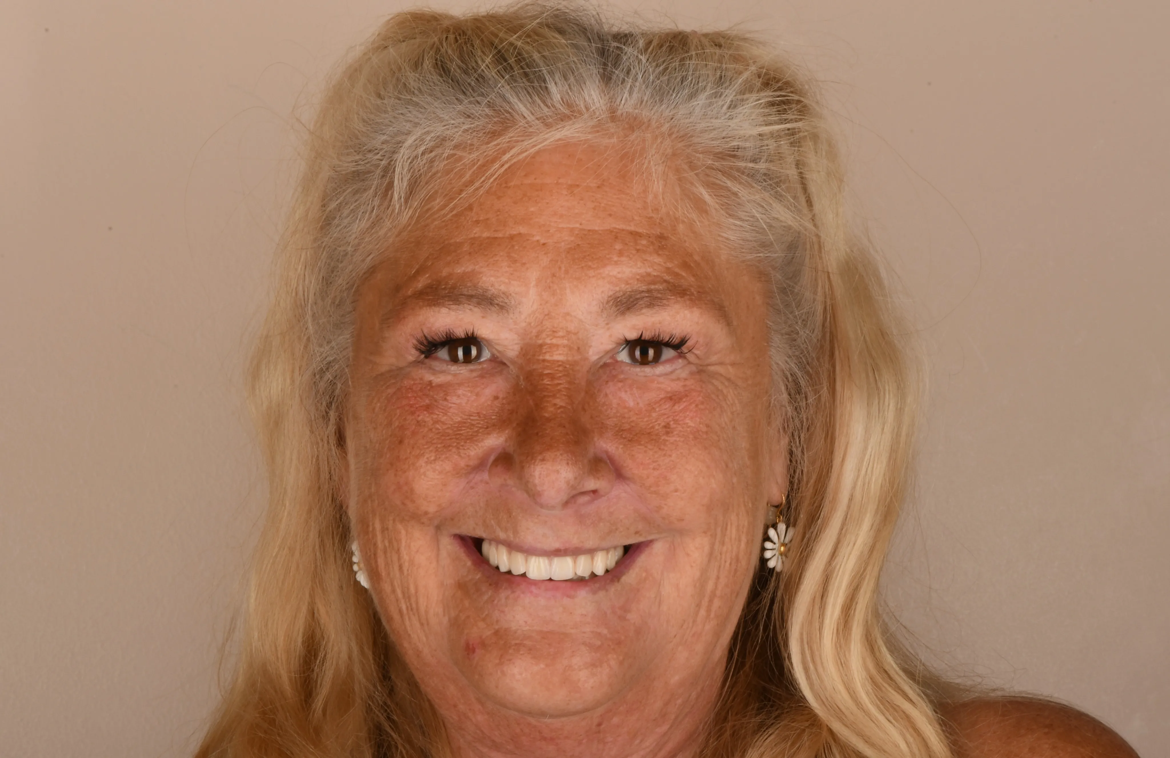 Patient face after treatment