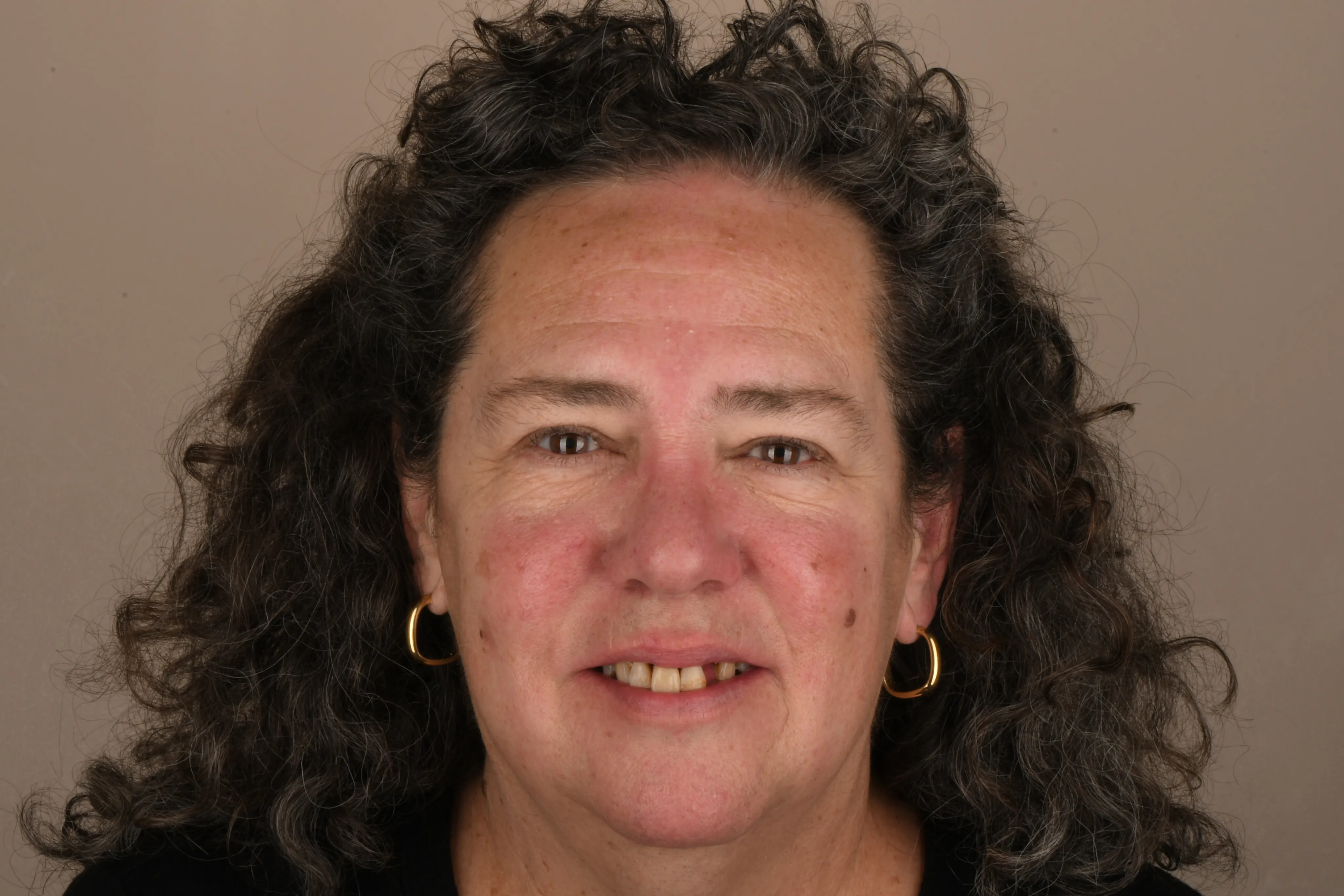 Patient face before treatment