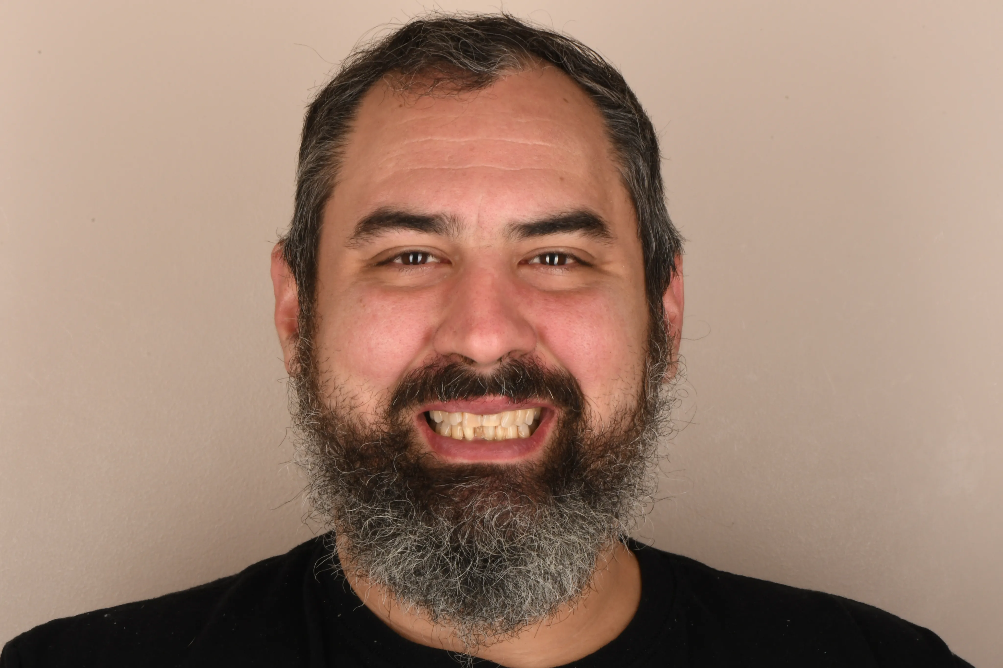 Patient face before treatment