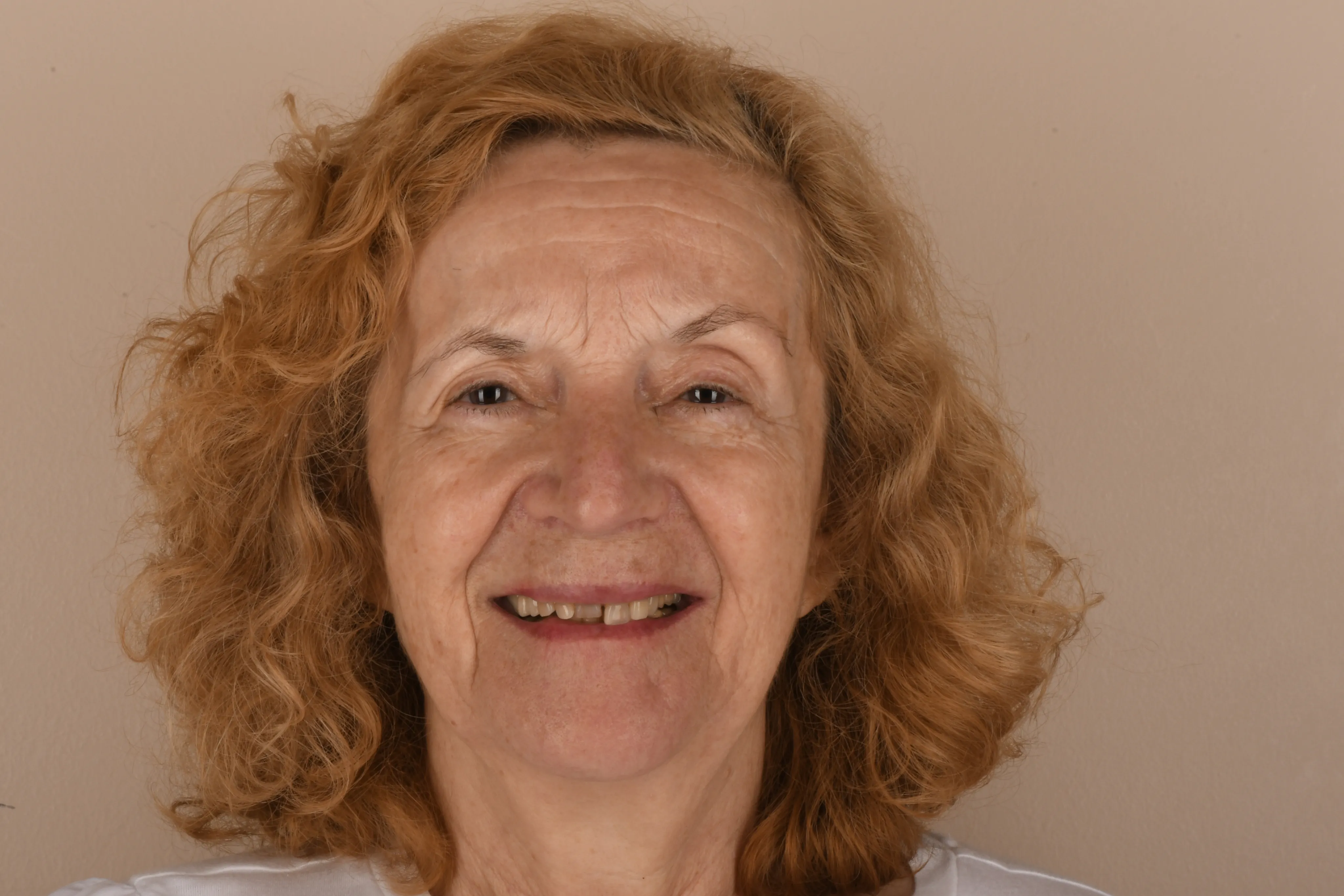Patient face before treatment