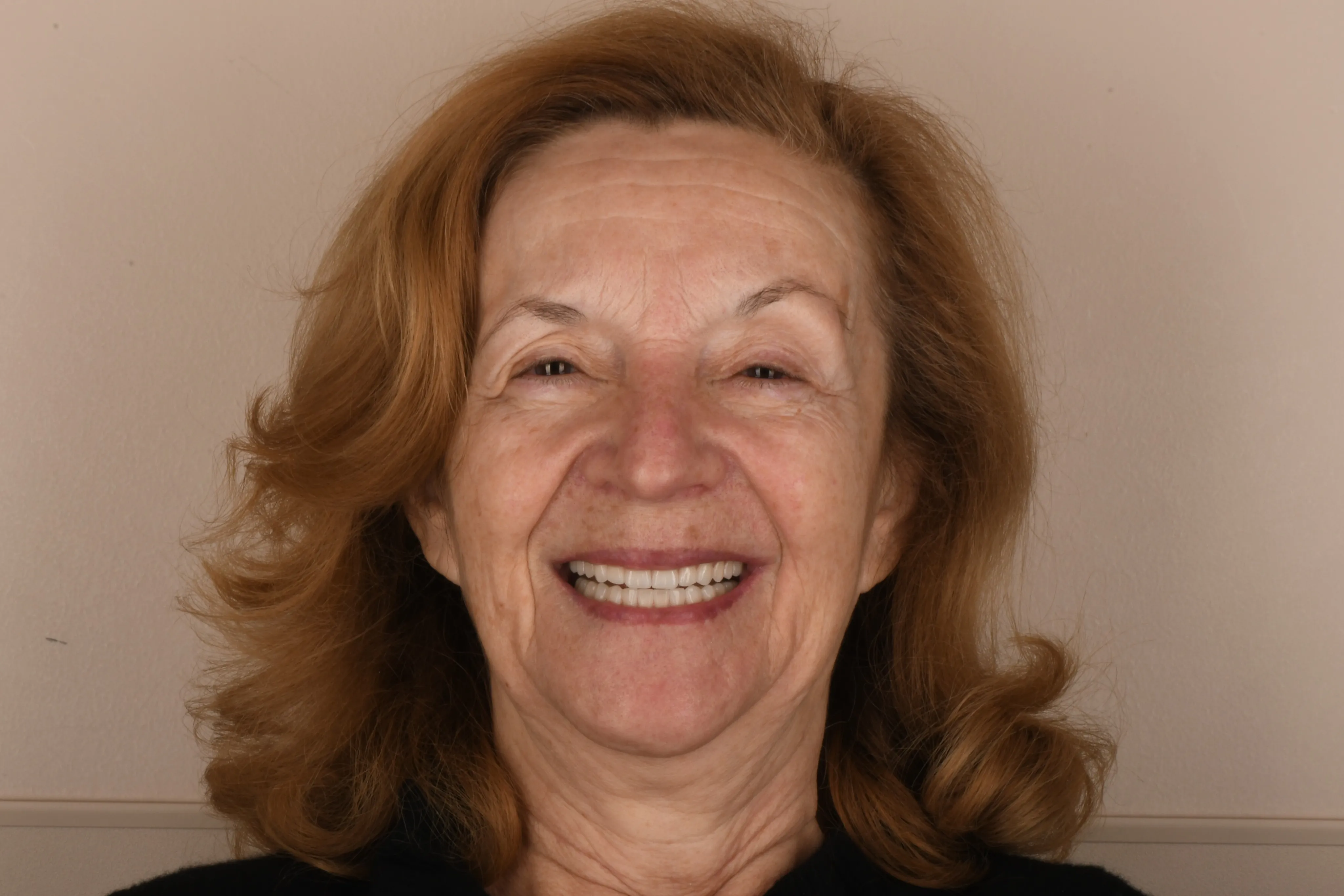 Patient face after treatment