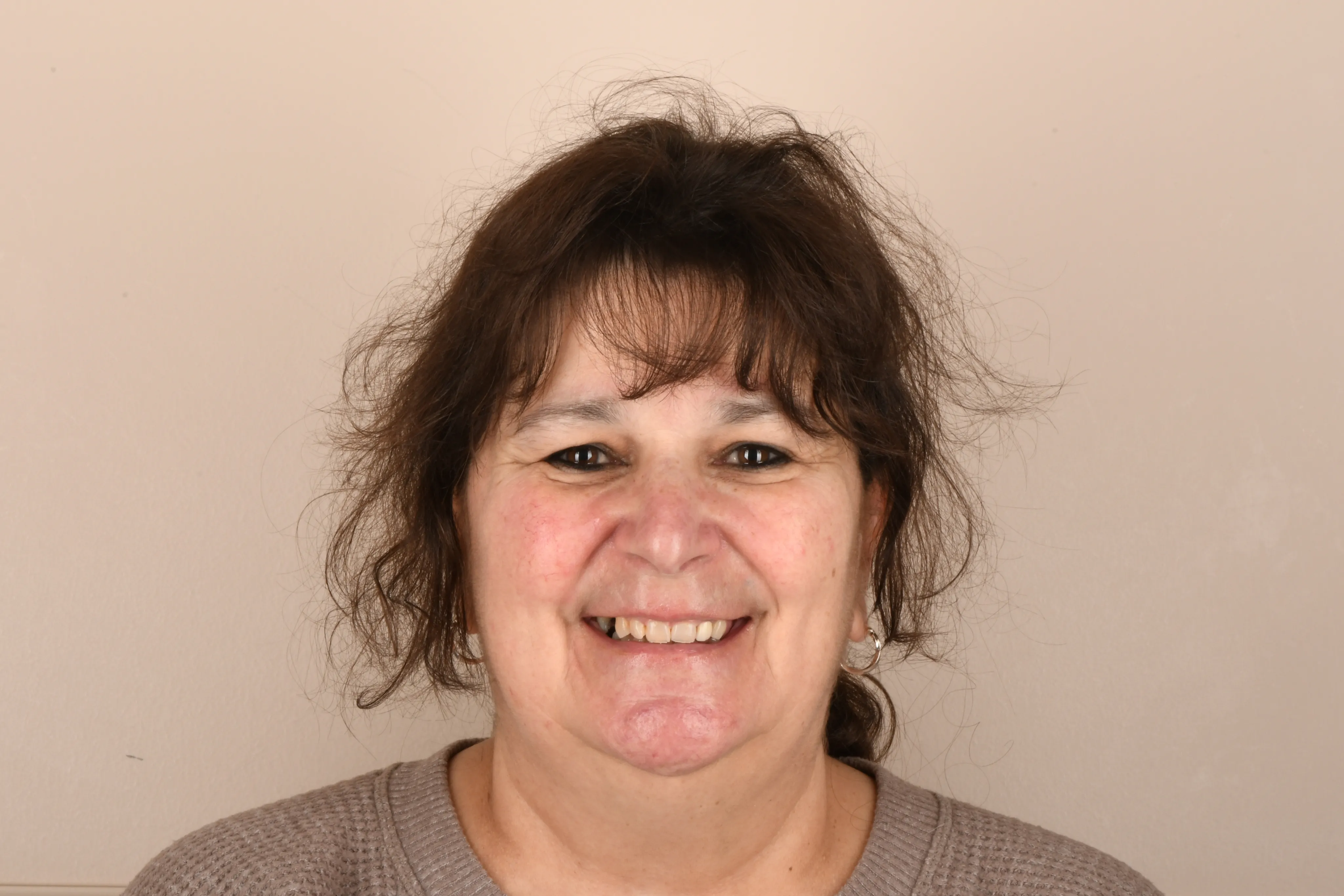 Patient face before treatment