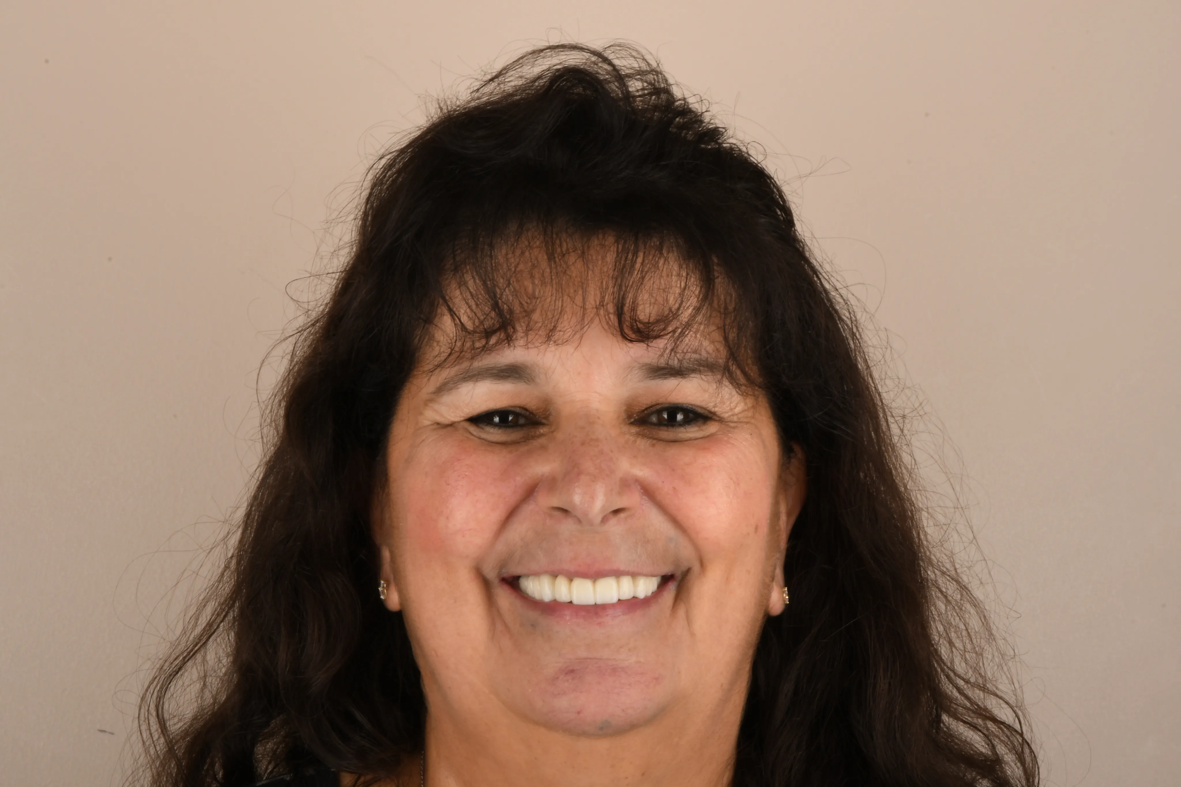 Patient face after treatment