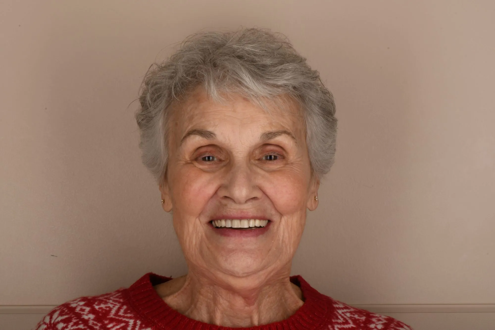 Patient face before treatment