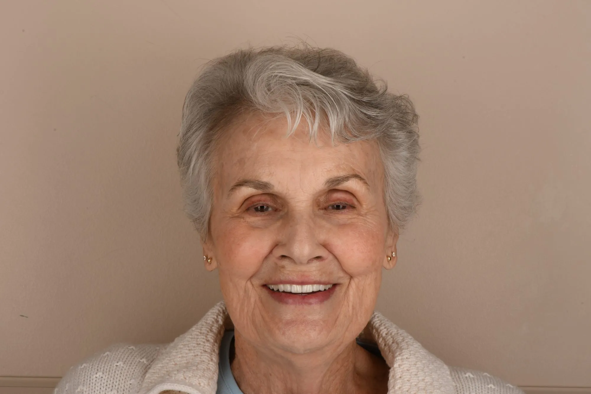 Patient face after treatment