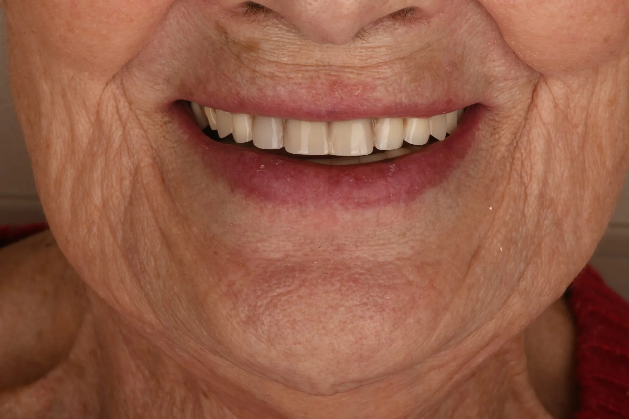 Smile close-up before treatment