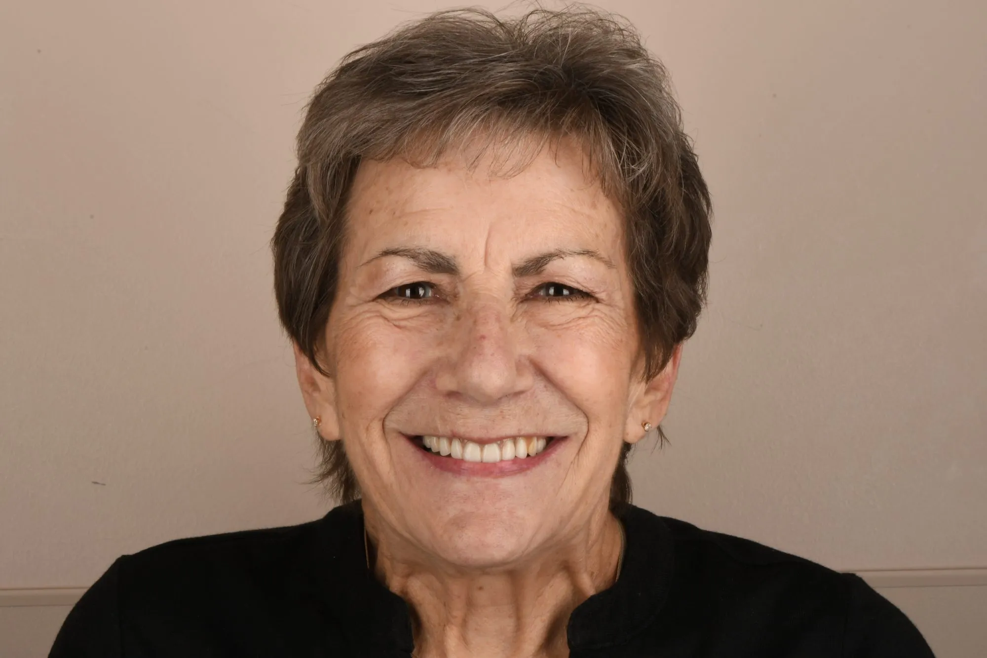 Patient face before treatment