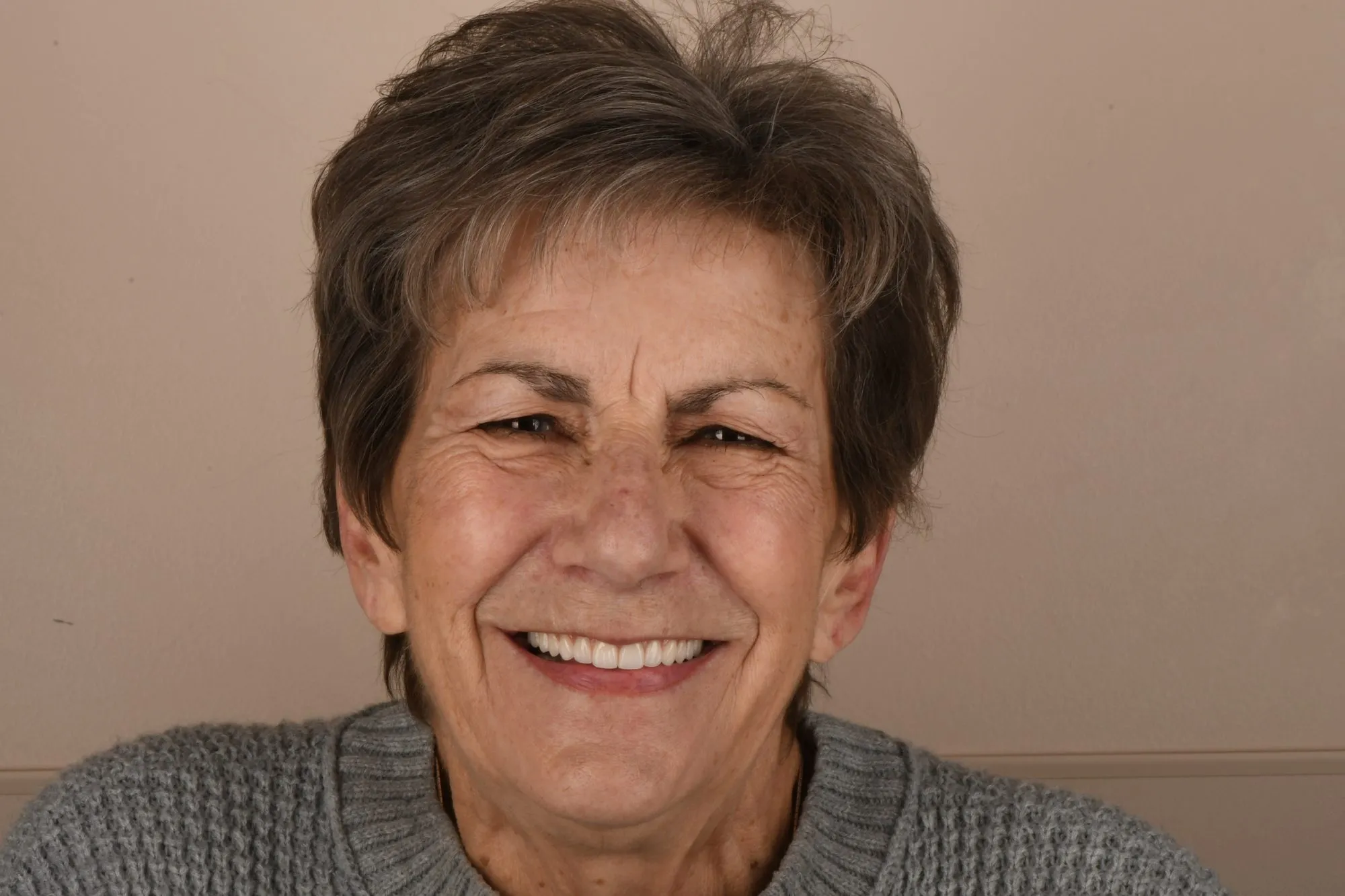 Patient face after treatment