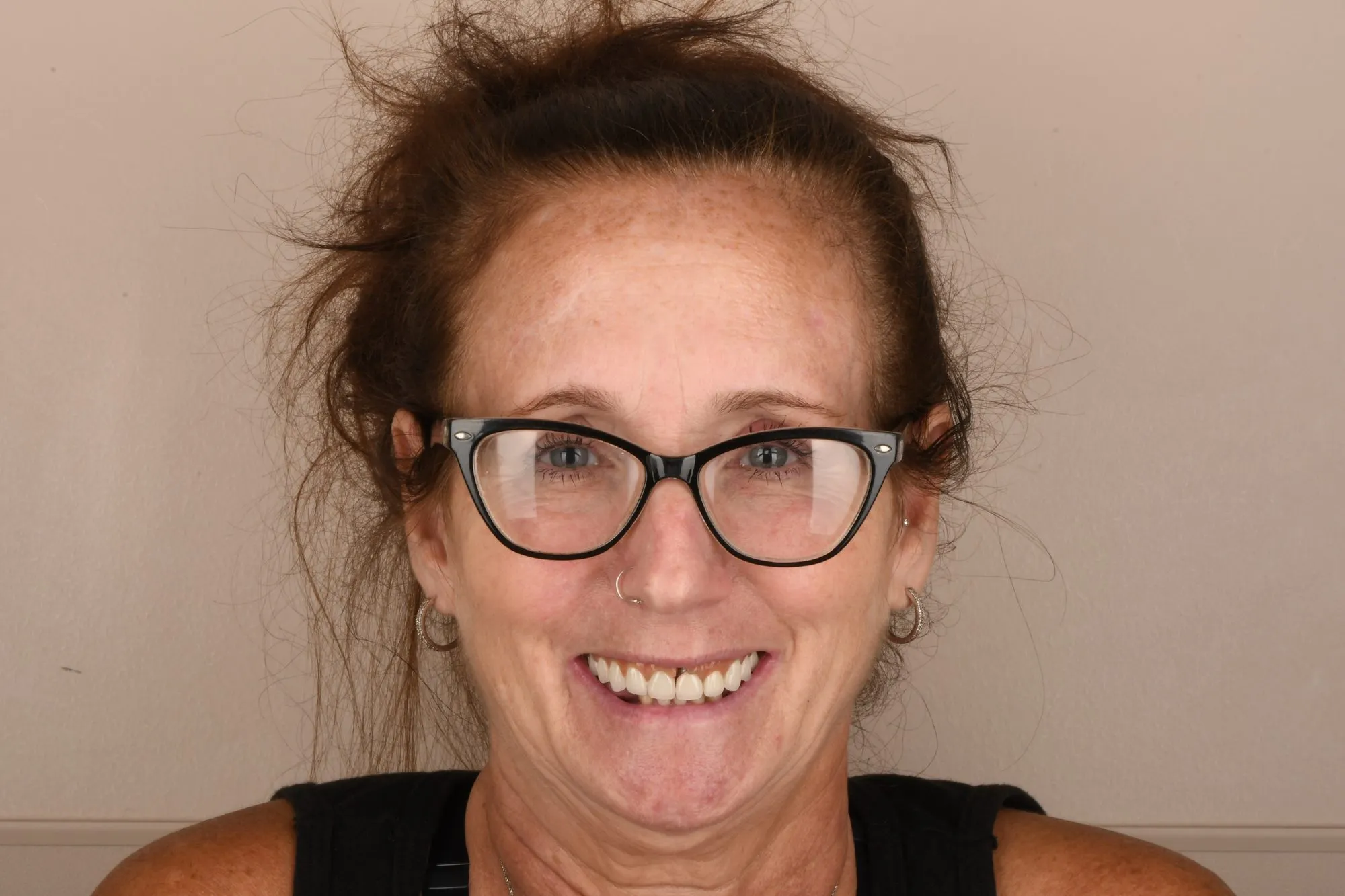 Patient face before treatment