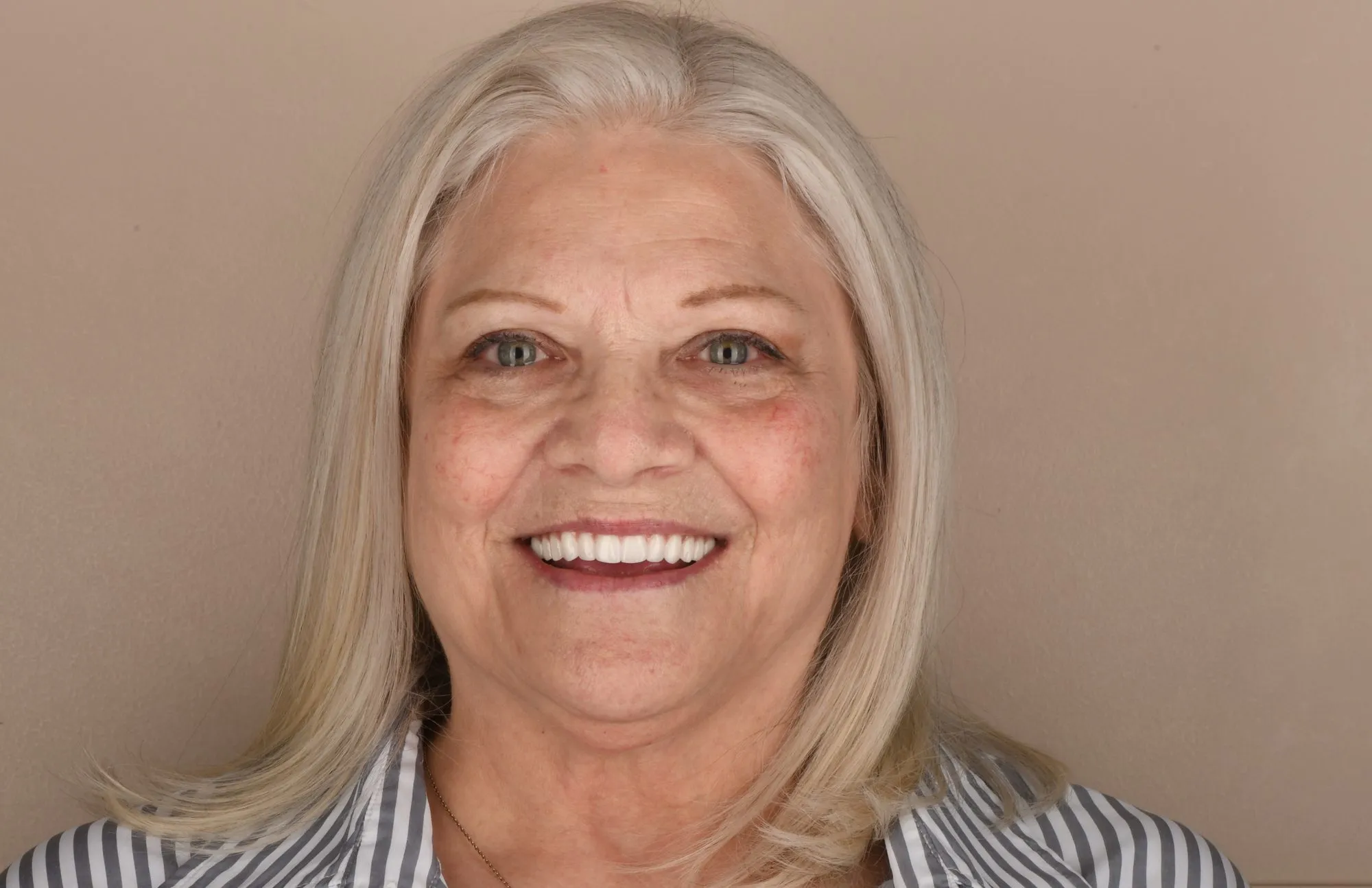 Patient face after treatment