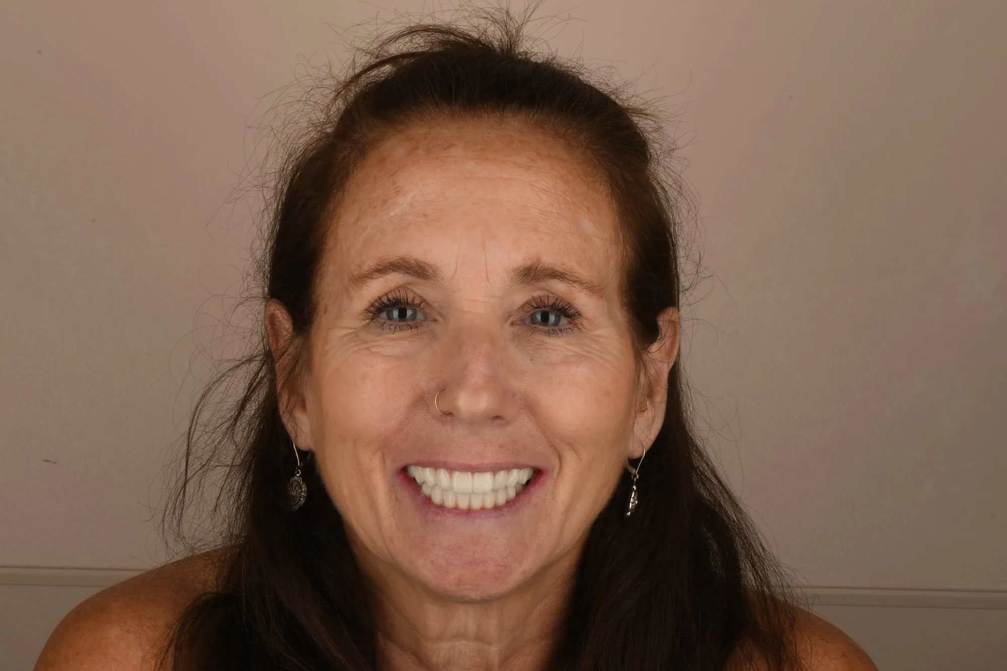 Patient face after treatment