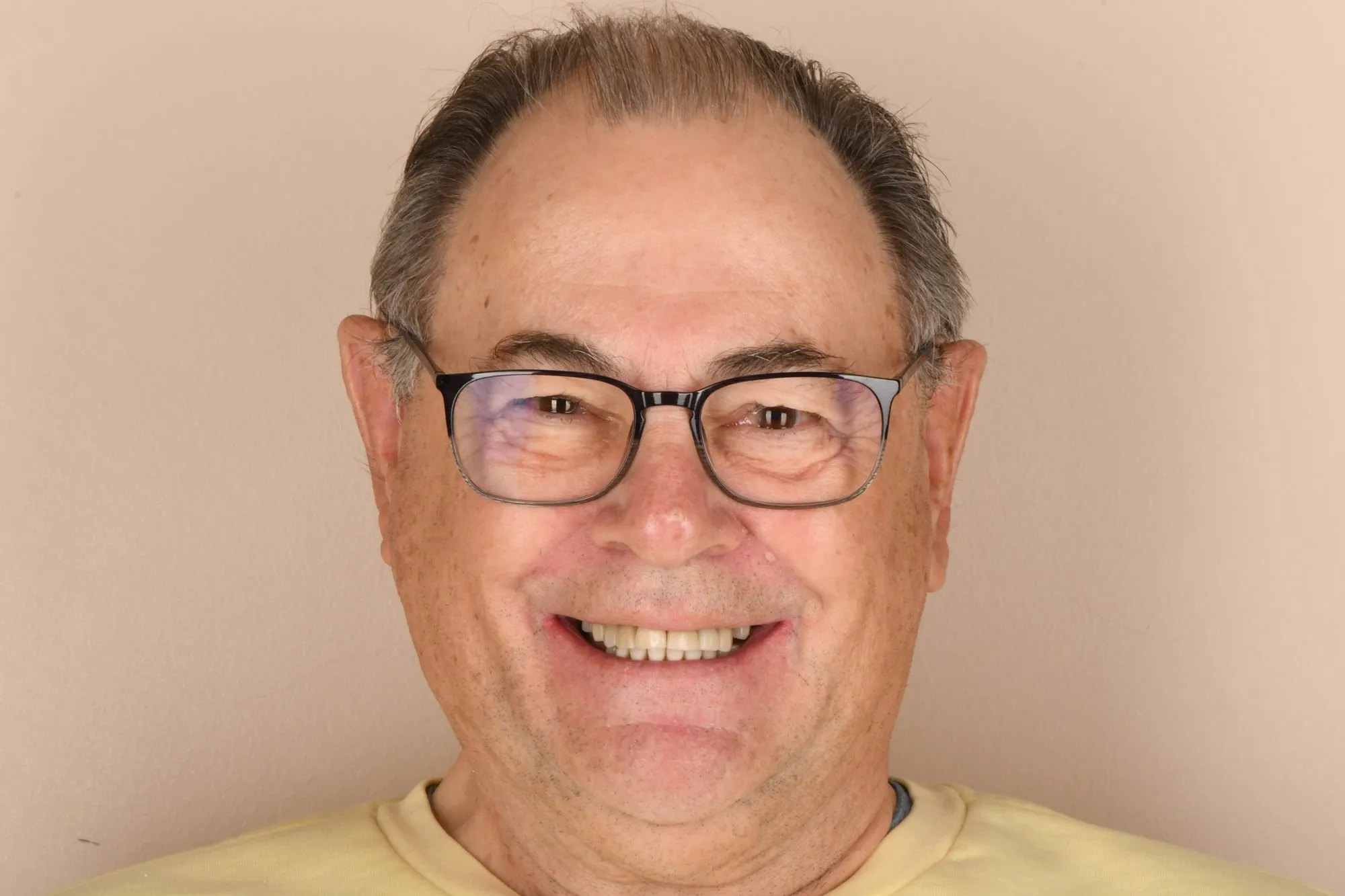 Patient face before treatment