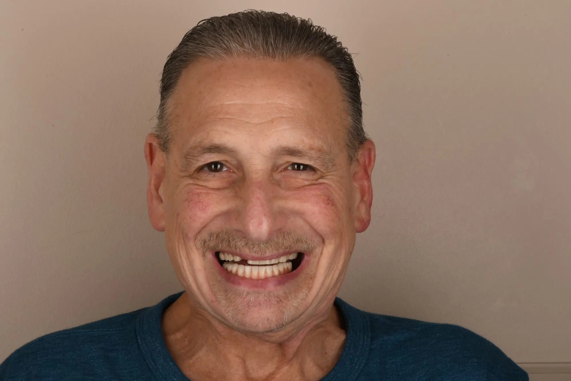 Patient face before treatment