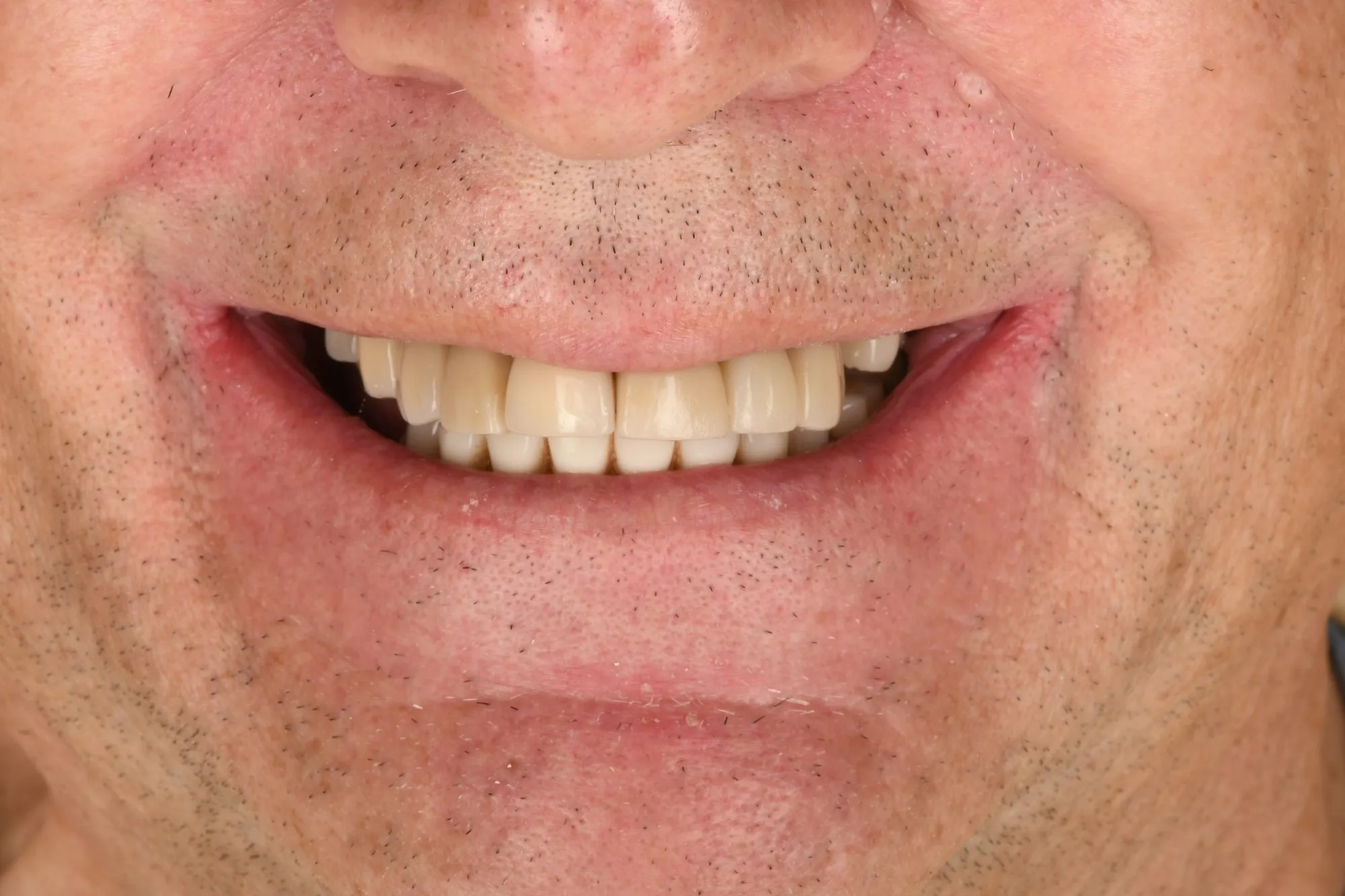 Smile close-up before treatment