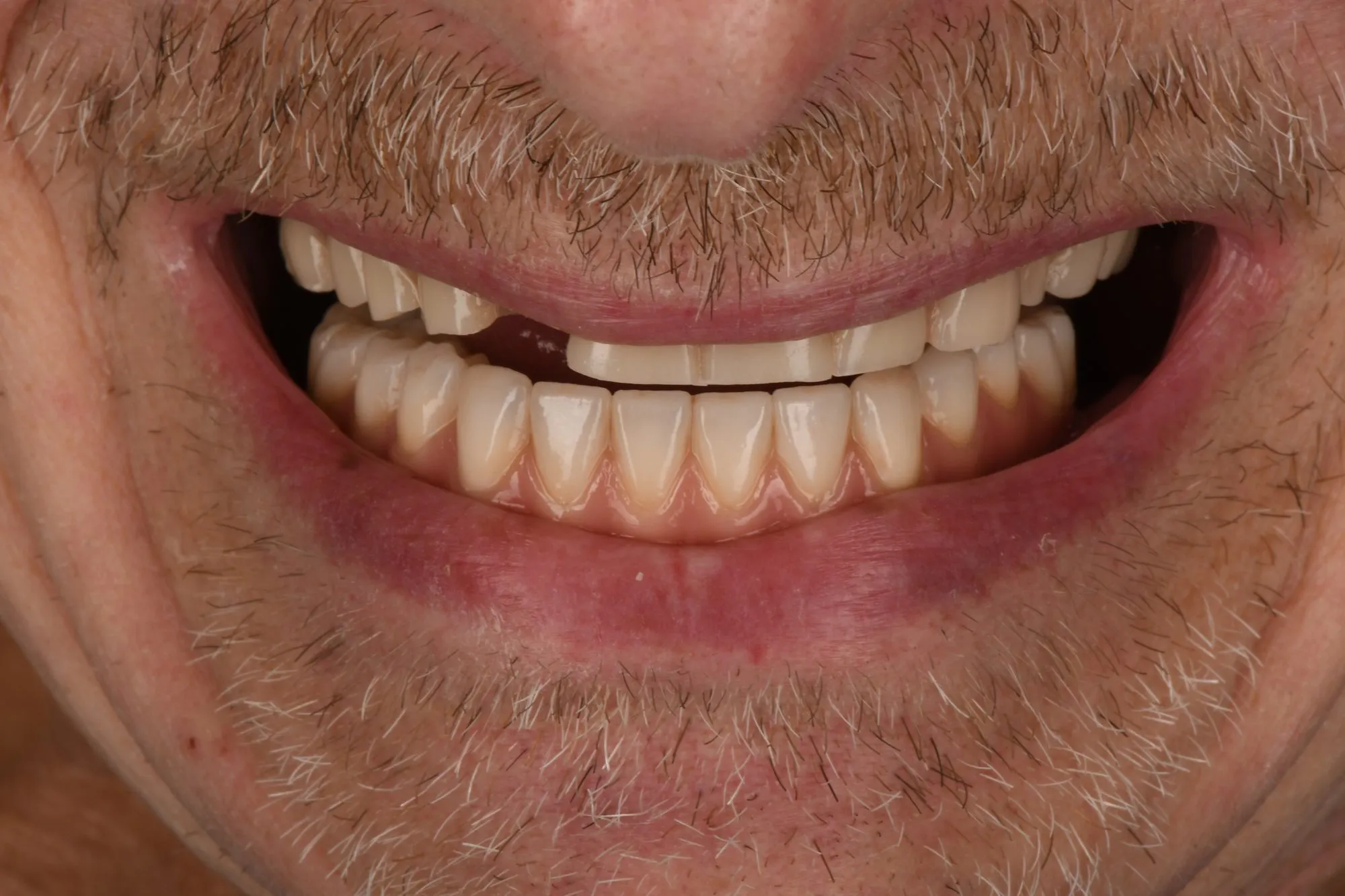 Smile close-up before treatment