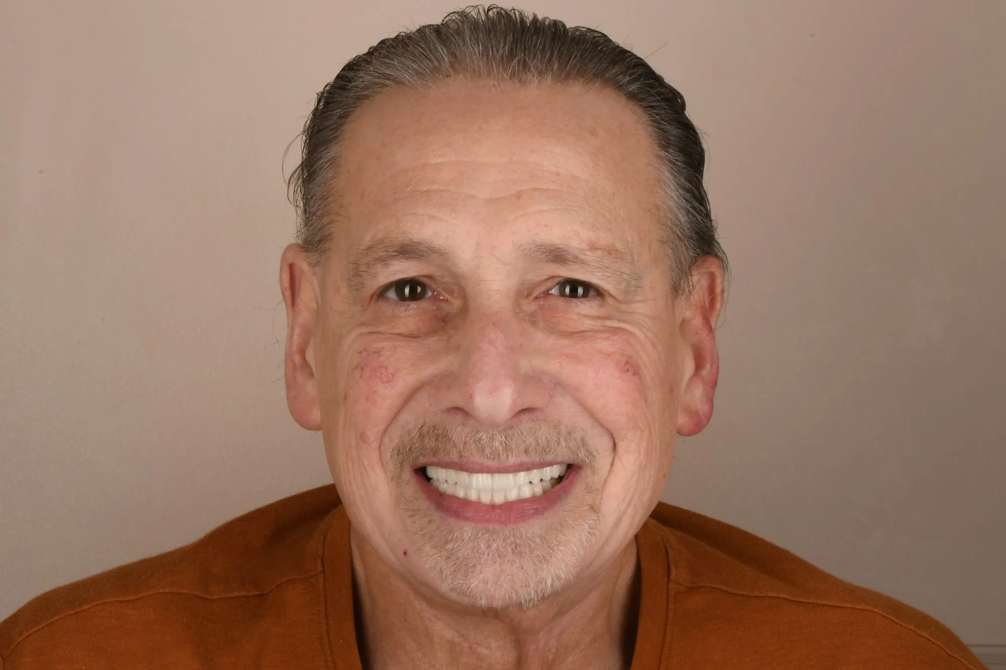 Patient face after treatment
